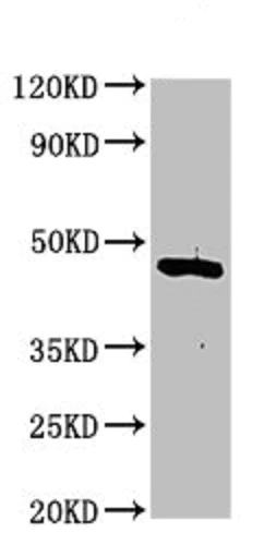 Western blot - Anti-Casein Kinase 1 delta/CSNK1D antibody (AB236601)