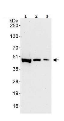 Western blot - Anti-Casein Kinase 1 delta/CSNK1D antibody (AB264278)