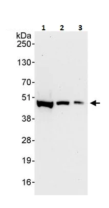 Western blot - Anti-Casein Kinase 1 delta/CSNK1D antibody (AB264278)