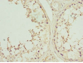 Immunohistochemistry (Formalin/PFA-fixed paraffin-embedded sections) - Anti-Casein Kinase 1 gamma 2 antibody (AB230045), expandable thumbnail