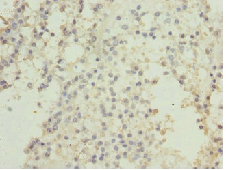 Immunohistochemistry (Formalin/PFA-fixed paraffin-embedded sections) - Anti-Casein Kinase 1 gamma 2 antibody (AB230045), expandable thumbnail