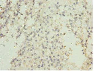 Immunohistochemistry (Formalin/PFA-fixed paraffin-embedded sections) - Anti-Casein Kinase 1 gamma 2 antibody (AB230045)