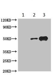 Immunoprecipitation - Anti-Casein Kinase 1 gamma 2 antibody (AB230045), expandable thumbnail