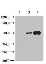 Immunoprecipitation - Anti-Casein Kinase 1 gamma 2 antibody (AB230045)