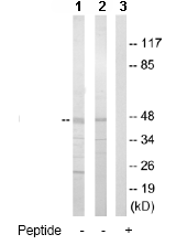 Western blot - Anti-Casein Kinase 1 gamma 2 antibody (AB64829)