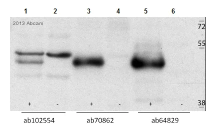 Western blot - Anti-Casein Kinase 1 gamma 2 antibody (AB64829)