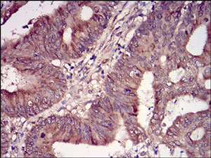Immunohistochemistry (Formalin/PFA-fixed paraffin-embedded sections) - Anti-Casein Kinase 2 beta antibody [2F12F3] (AB201990)