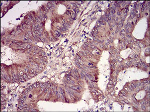 Immunohistochemistry (Formalin/PFA-fixed paraffin-embedded sections) - Anti-Casein Kinase 2 beta antibody [2F12F3] (AB201990)