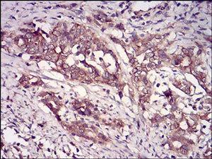 Immunohistochemistry (Formalin/PFA-fixed paraffin-embedded sections) - Anti-Casein Kinase 2 beta antibody [2F12F3] (AB201990)