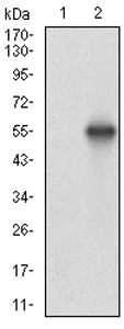 Western blot - Anti-Casein Kinase 2 beta antibody [2F12F3] (AB201990)