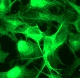 Immunocytochemistry/ Immunofluorescence - Anti-Casein Kinase 2 beta antibody [EP1995Y] (AB76025), expandable thumbnail