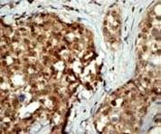 Immunohistochemistry (Formalin/PFA-fixed paraffin-embedded sections) - Anti-Casein Kinase 2 beta antibody [EP1995Y] (AB76025), expandable thumbnail