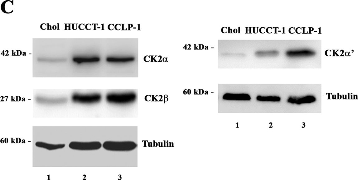 Western blot - Anti-Casein Kinase 2 beta antibody [EP1995Y] (AB76025), expandable thumbnail