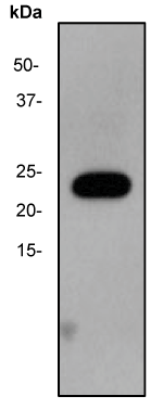 Western blot - Anti-Casein Kinase 2 beta antibody [EP1995Y] (AB76025), expandable thumbnail
