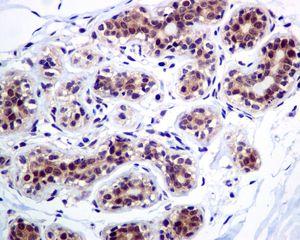 Immunohistochemistry (Formalin/PFA-fixed paraffin-embedded sections) - Anti-Casein Kinase 2 beta antibody [EPR1994] (AB133576), expandable thumbnail