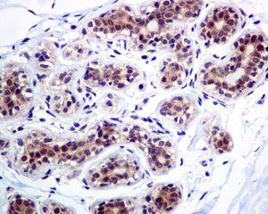 Immunohistochemistry (Formalin/PFA-fixed paraffin-embedded sections) - Anti-Casein Kinase 2 beta antibody [EPR1994] (AB133576)