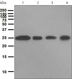 Western blot - Anti-Casein Kinase 2 beta antibody [EPR1994] (AB133576), expandable thumbnail