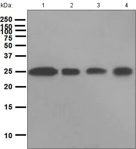 Western blot - Anti-Casein Kinase 2 beta antibody [EPR1994] (AB133576)
