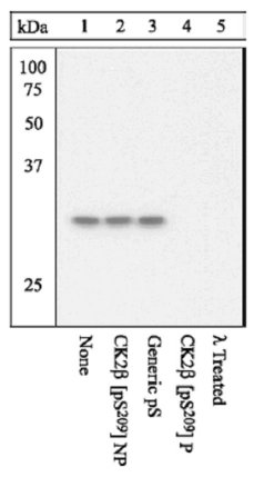 Western blot - Anti-Casein Kinase 2 beta (phospho S209) antibody (AB12861)