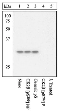 Western blot - Anti-Casein Kinase 2 beta (phospho S209) antibody (AB12861)