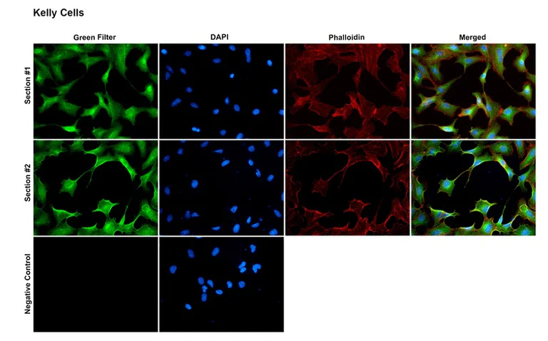 Immunocytochemistry/ Immunofluorescence - Anti-CASK antibody [PT55] (AB326349)
