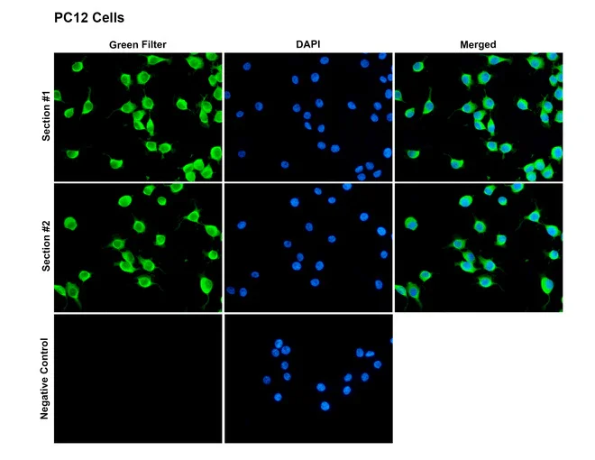 Immunocytochemistry/ Immunofluorescence - Anti-CASK antibody [PT55] (AB326349)