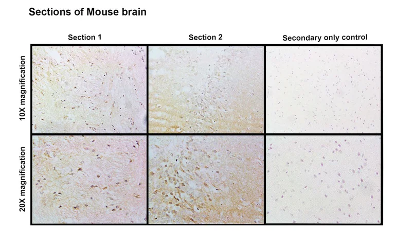 Immunohistochemistry (Formalin/PFA-fixed paraffin-embedded sections) - Anti-CASK antibody [PT55] (AB326349)