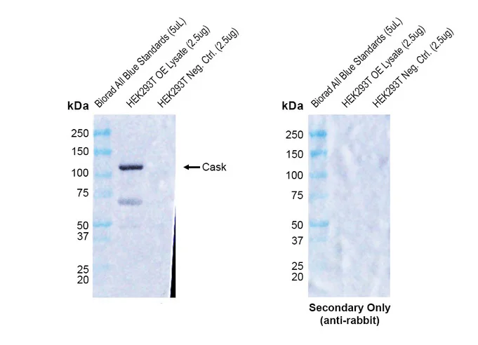 Western blot - Anti-CASK antibody [PT55] (AB326349)