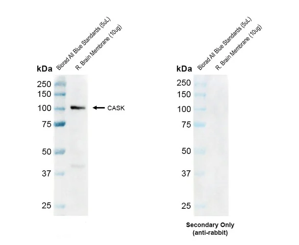 Western blot - Anti-CASK antibody [PT55] (AB326349)
