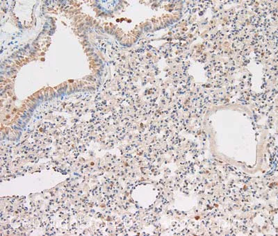 Immunohistochemistry (Formalin/PFA-fixed paraffin-embedded sections) - Anti-Caspase-1 antibody (AB138483)