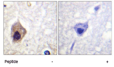 Immunohistochemistry (Formalin/PFA-fixed paraffin-embedded sections) - Anti-Caspase-1 antibody (AB62698)
