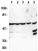 Western blot - Anti-Caspase-10/CASP-10 antibody (AB2012)