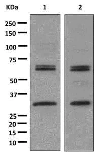 Western blot - Anti-Caspase-10/CASP-10 antibody [EPR10890] - BSA and Azide free (AB249980)