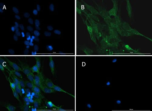 Immunocytochemistry/ Immunofluorescence - Anti-Caspase-12 antibody (AB235180)
