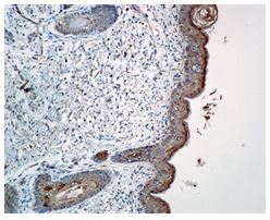 Immunohistochemistry (Formalin/PFA-fixed paraffin-embedded sections) - Anti-Caspase-14 antibody [EPR12927] (AB174847), expandable thumbnail