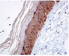 Immunohistochemistry (Formalin/PFA-fixed paraffin-embedded sections) - Anti-Caspase-14 antibody [EPR12927] - BSA and Azide free (AB249835)