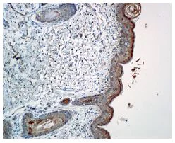 Immunohistochemistry (Formalin/PFA-fixed paraffin-embedded sections) - Anti-Caspase-14 antibody [EPR12927] - BSA and Azide free (AB249835)