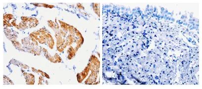 Immunohistochemistry (Formalin/PFA-fixed paraffin-embedded sections) - Anti-Caspase-2 antibody (AB182657)