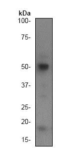Western blot - Anti-Caspase-2 antibody [Y154] (AB32021)