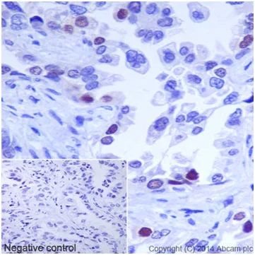 Immunohistochemistry (Formalin/PFA-fixed paraffin-embedded sections) - Anti-Caspase-2L antibody [EPR16790] - BSA and Azide free (AB250106)