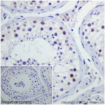 Immunohistochemistry (Formalin/PFA-fixed paraffin-embedded sections) - Anti-Caspase-2L antibody [EPR16790] - BSA and Azide free (AB250106)