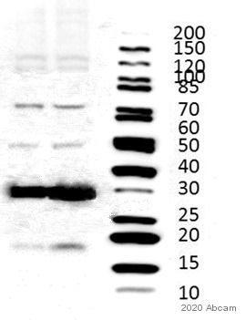 Western blot - Anti-Caspase-3 antibody (AB13847), expandable thumbnail