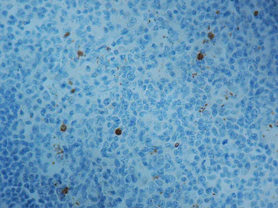 Immunohistochemistry (Formalin/PFA-fixed paraffin-embedded sections) - Anti-Caspase-3 antibody (AB4051)