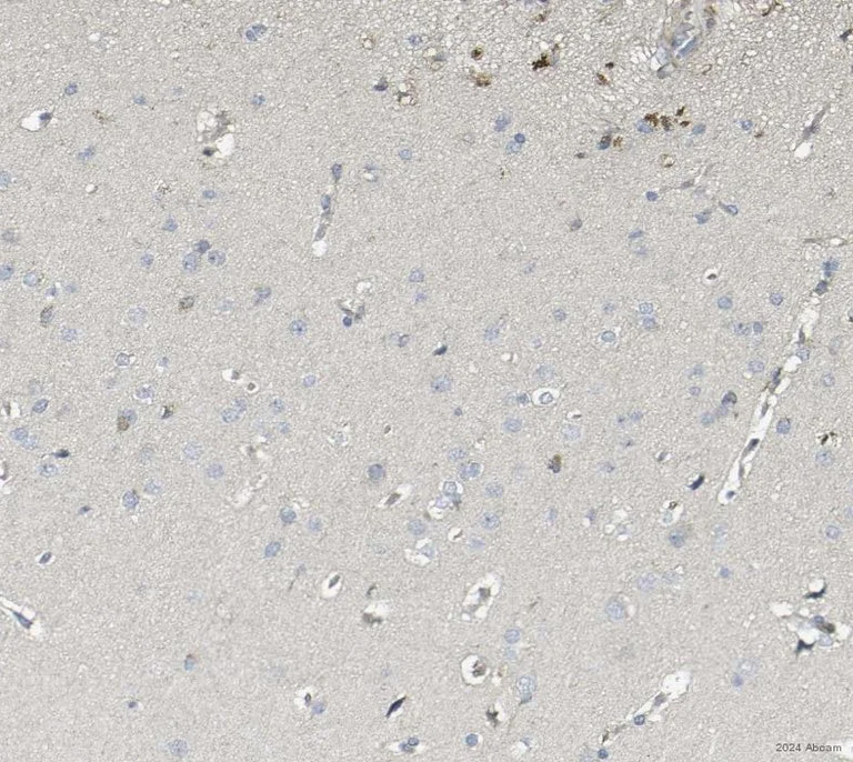Immunohistochemistry (Formalin/PFA-fixed paraffin-embedded sections) - Anti-Caspase-3 antibody (AB4051)