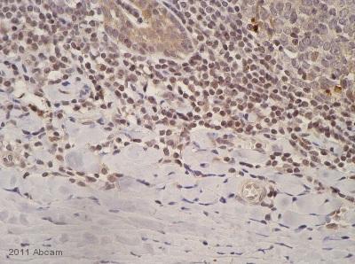 Immunohistochemistry (Formalin/PFA-fixed paraffin-embedded sections) - Anti-Caspase-3 antibody (AB4051)