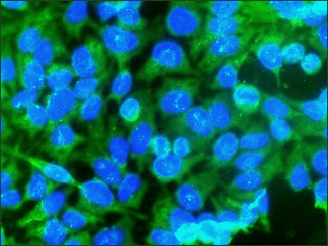 Immunocytochemistry/ Immunofluorescence - Anti-Caspase-3 antibody (AB49822)