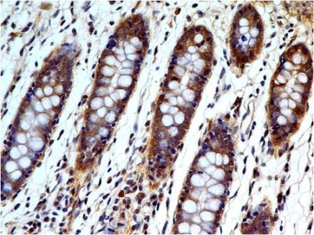 Immunohistochemistry (Formalin/PFA-fixed paraffin-embedded sections) - Anti-Caspase-3 antibody [ABM1C12] (AB208161), expandable thumbnail