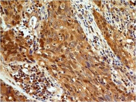 Immunohistochemistry (Formalin/PFA-fixed paraffin-embedded sections) - Anti-Caspase-3 antibody [ABM1C12] (AB208161), expandable thumbnail