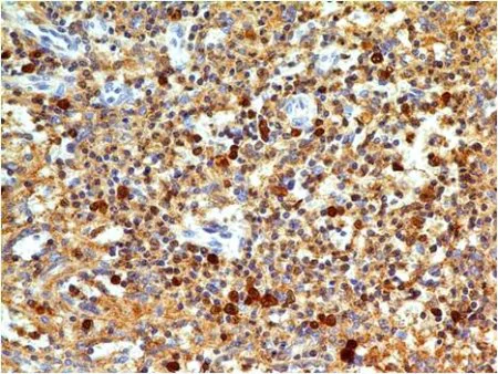 Immunohistochemistry (Formalin/PFA-fixed paraffin-embedded sections) - Anti-Caspase-3 antibody [ABM1C12] (AB208161)
