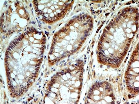 Immunohistochemistry (Formalin/PFA-fixed paraffin-embedded sections) - Anti-Caspase-3 antibody [ABM1C12] (AB208161), expandable thumbnail